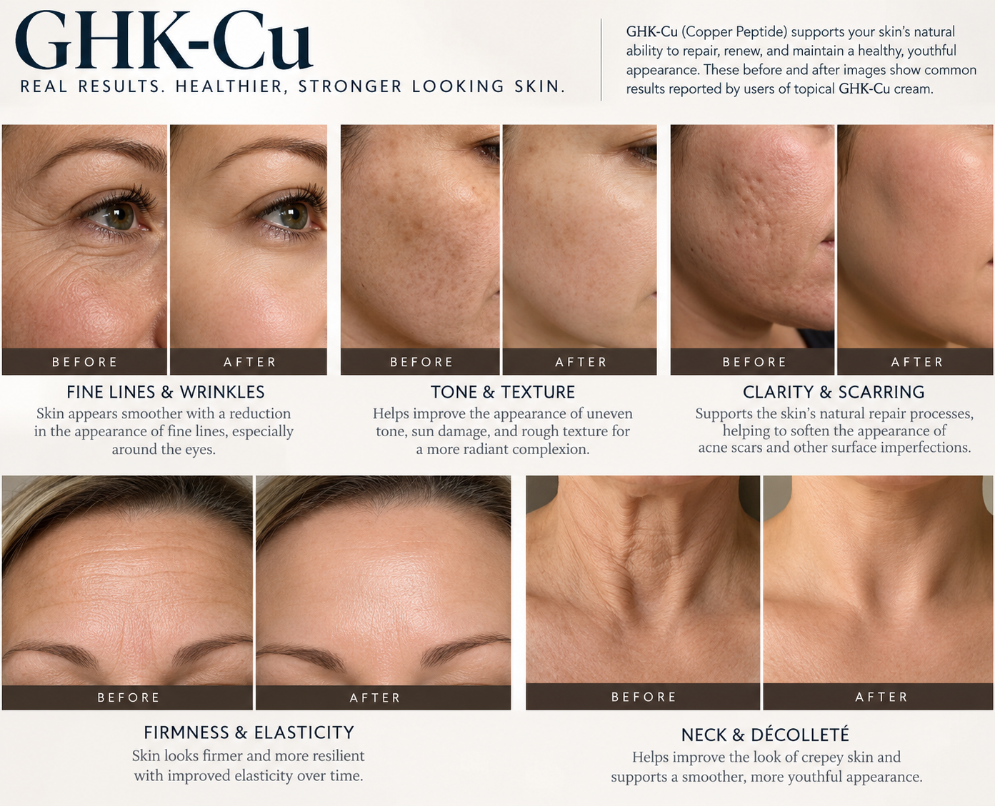 GHK-Cu skincare graphic showing before-and-after comparisons for fine lines and wrinkles, tone and texture, clarity and scarring, firmness and elasticity, and neck and décolleté